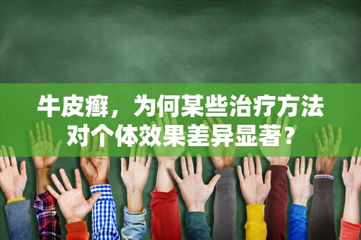 牛皮癣，为何某些治疗方法对个体效果差异显著？