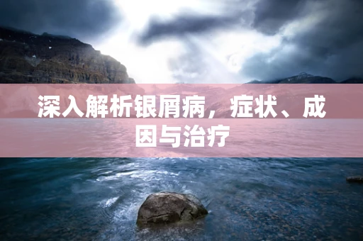 深入解析银屑病，症状、成因与治疗