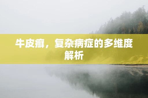 牛皮癣，复杂病症的多维度解析