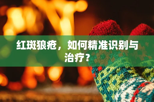 红斑狼疮，如何精准识别与治疗？
