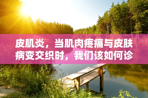 皮肌炎，当肌肉疼痛与皮肤病变交织时，我们该如何诊断？