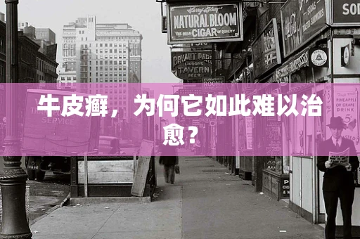 牛皮癣，为何它如此难以治愈？