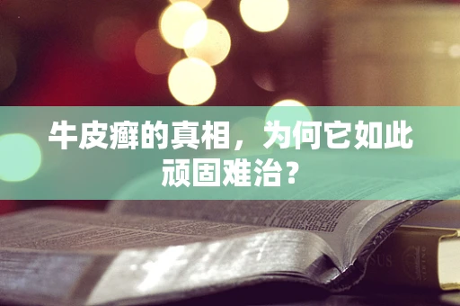 牛皮癣的真相，为何它如此顽固难治？